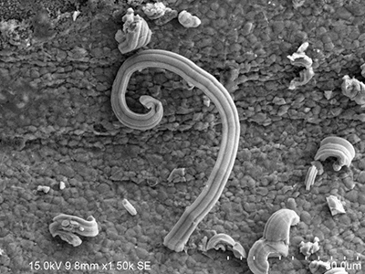 錫須觀察與測(cè)量